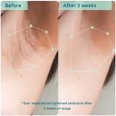 Bodycare Pigmentation Duo 4