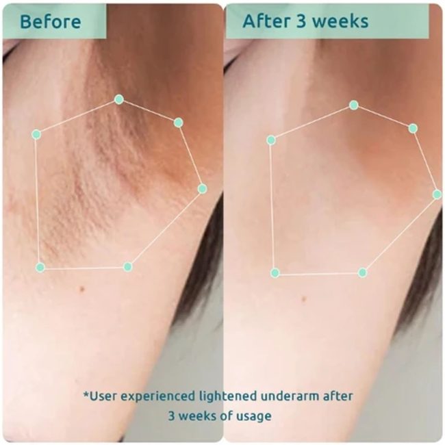 Bodycare Pigmentation Duo 4