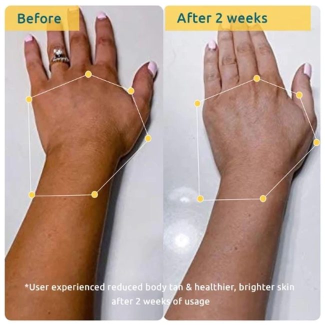 Bodycare Pigmentation Duo 5