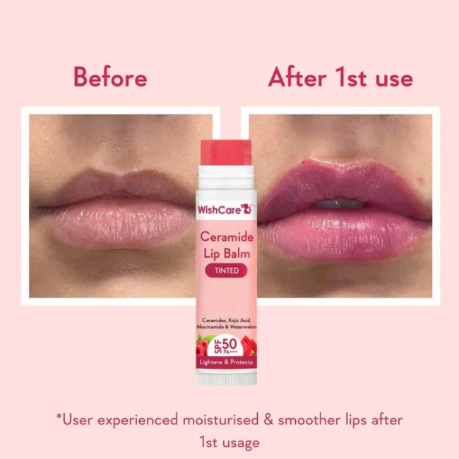 Ceramide Lip Balm with SPF 50 PA+++ (Tinted) 2 Ceramide Lip Balm with SPF 50 PA+++ (Tinted)