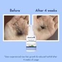 Hair Growth Serum Concentrate 30ml 4